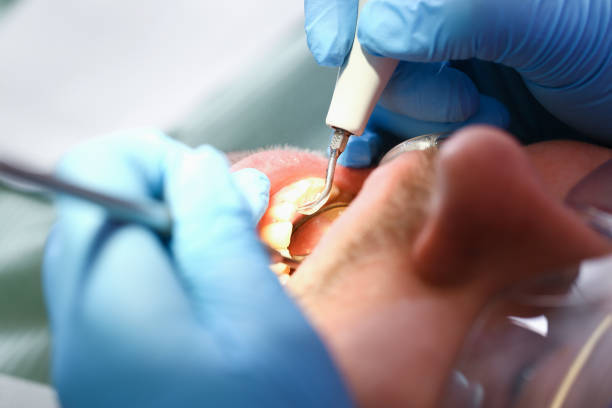 Best Emergency Denture Repair in Kemp Mill, MD