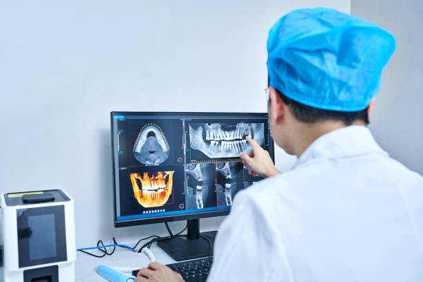 Best Emergency Wisdom Teeth Removal in Kemp Mill, MD